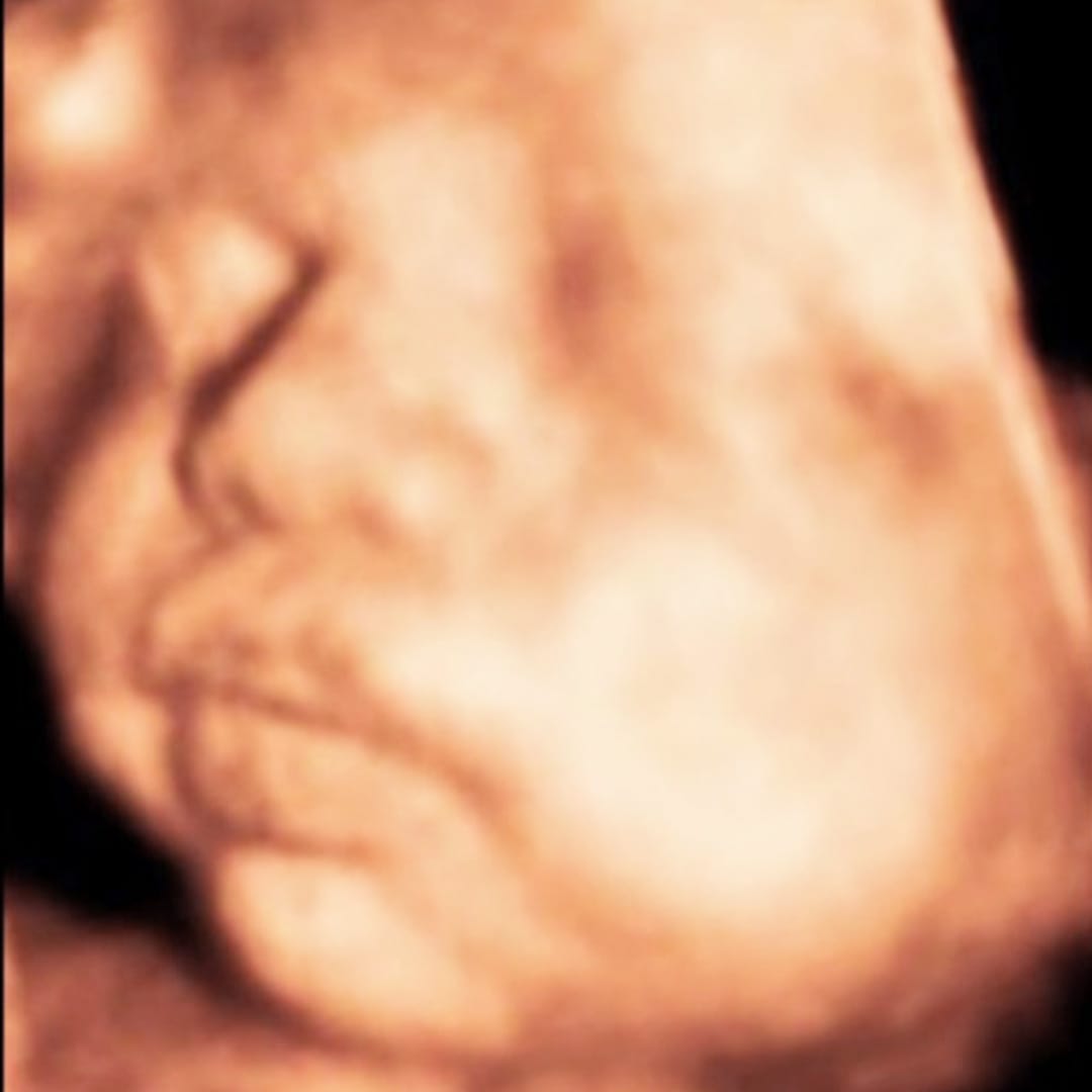 صورة سونار قبل المعالجة